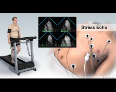 ECG Test